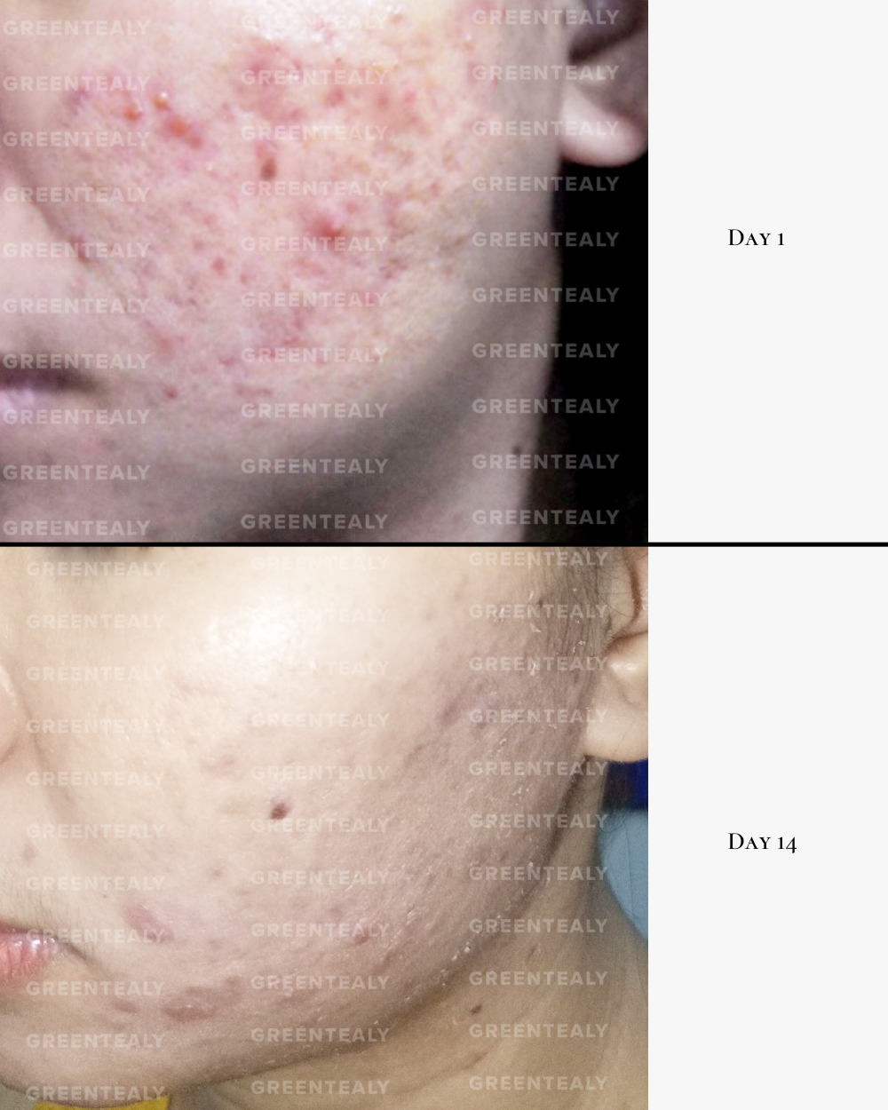 Active Antioxidant Serum
