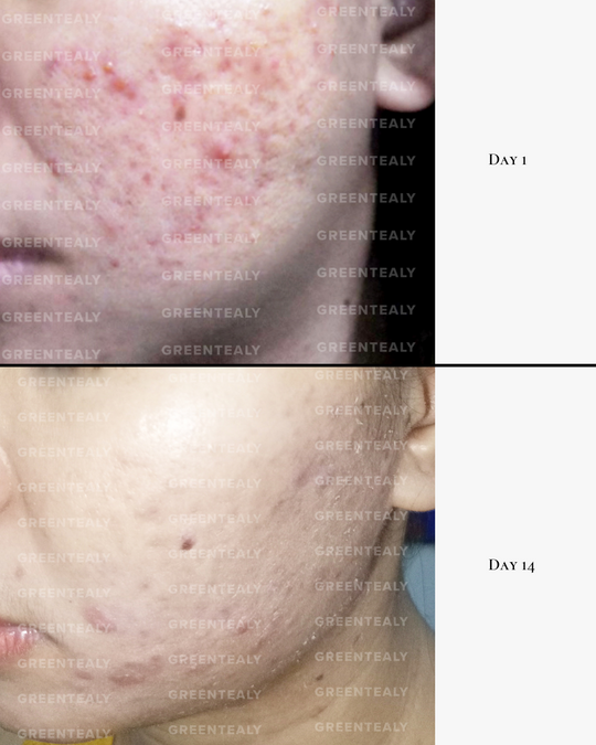 Active Antioxidant Serum