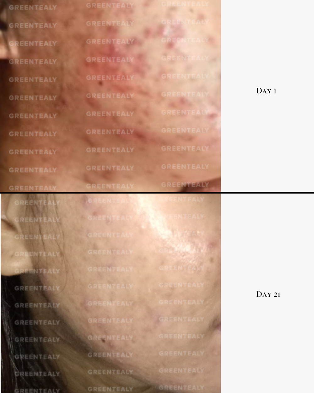 Active Antioxidant Serum